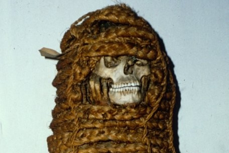 Antibiotic-resistant genes found in ancient mummy