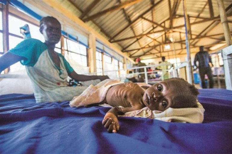 Cheap microscope invented for poor nations