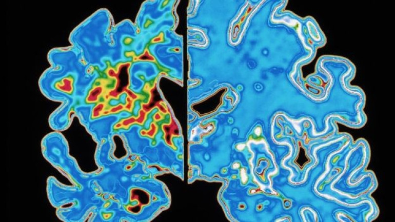 Virtual reality maze 'predicts Alzheimer's disease'