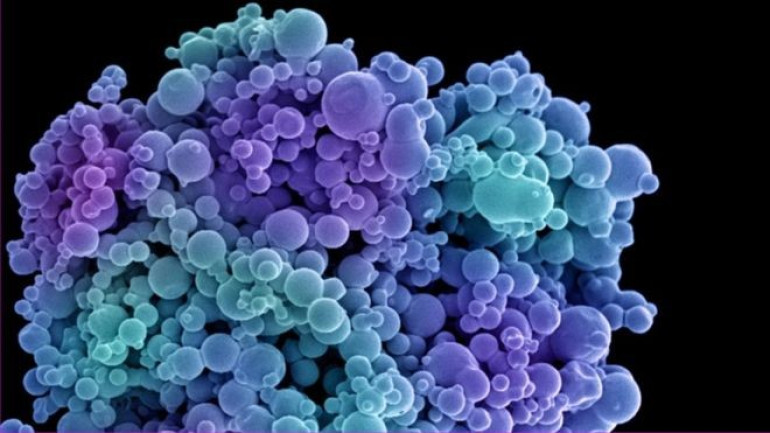 Heat-triggered 'grenades' kill cancer cells