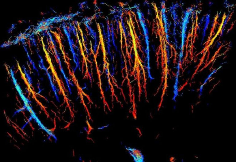 Ultrasound captures rat brain in microscopic 3D