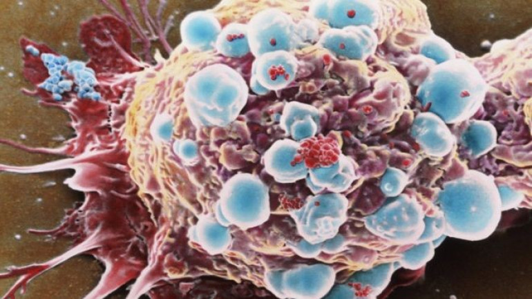 Cancer not bad luck but down to environment, study suggests