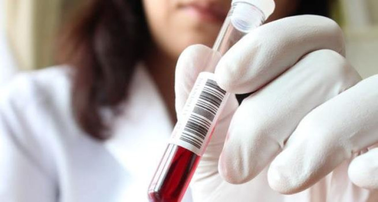 Թուրքիայում խոզի գրիպից 27 մարդ է մահացել