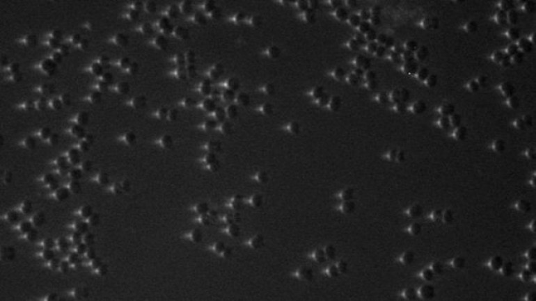 Bacteria 'see' like tiny eyeballs