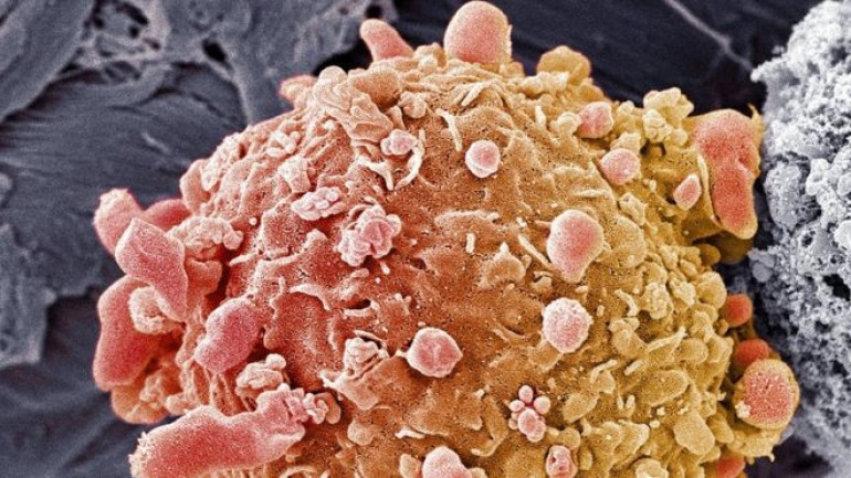 Skin cancer breakthrough: Pair of drugs 'eliminate 20% of tumours'