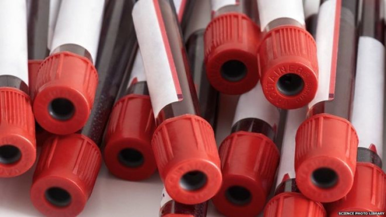 New blood test targets depression