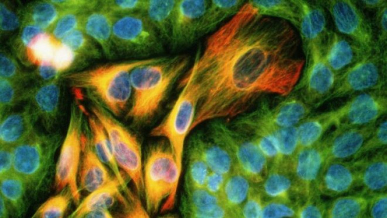 Pioneering cancer drug combination approved