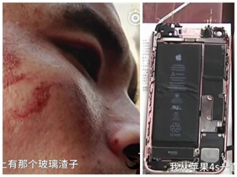 iPhone 7 взорвался перед лицом владельца