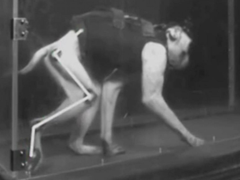'Brain wi-fi' reverses leg paralysis in primate first