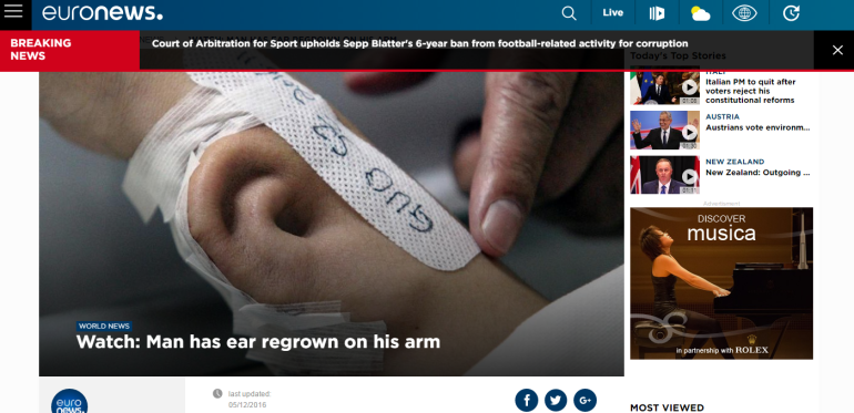 Chinese plastic surgeons regenerate ear on man’s arm
