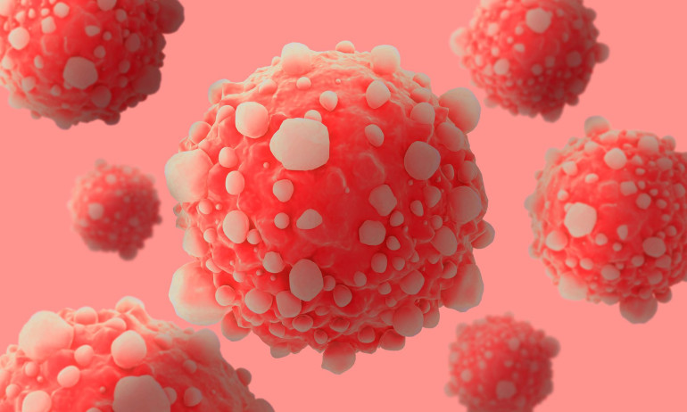 Trial finds combination of pancreatic cancer drugs extends survival
 