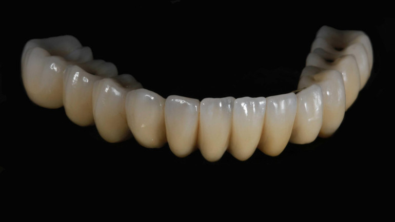 Դուբայում կներկայացվի եռաչափ տպագրության միջոցով ստեղծված առաջին ատամնաշարը