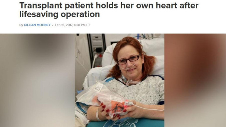 Woman holds own heart in hands after life-saving surgery