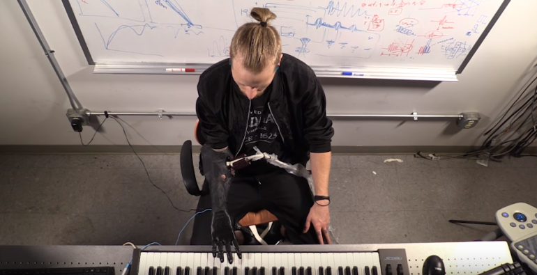 Musician who lost arm can play piano again with 'insanely cool prosthetic' (video)