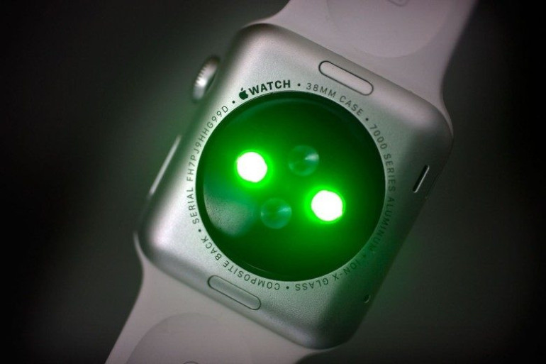 Apple Watch-ն ախտորոշում է շաքարային դիաբետը 85 տոկոս ճշգրտությամբ. Cult of Mac