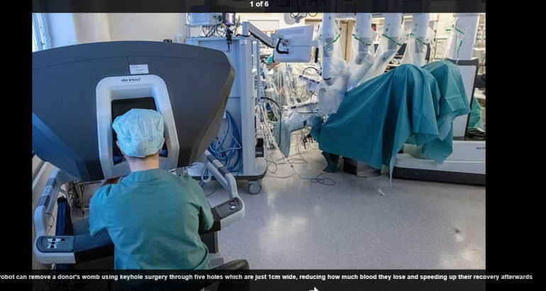 Medical breakthrough: Swedish woman becomes world's first to get pregnant after having a womb transplant performed through robot
 