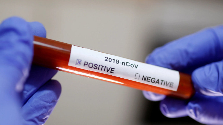 Health minister reports 30 confirmed coronavirus cases in Armenia Health minister reports 30 confirmed coronavirus cases in Armenia