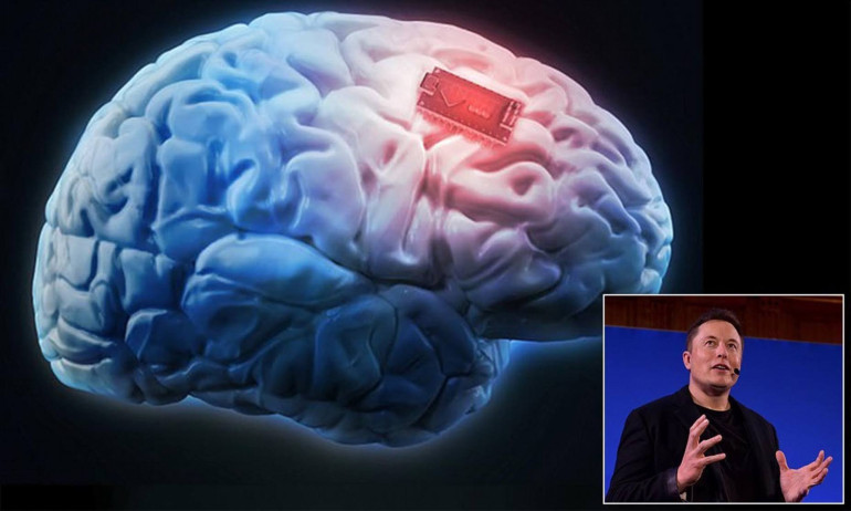Elon Musk's brain-chip company 'may be putting implants in humans' within a year