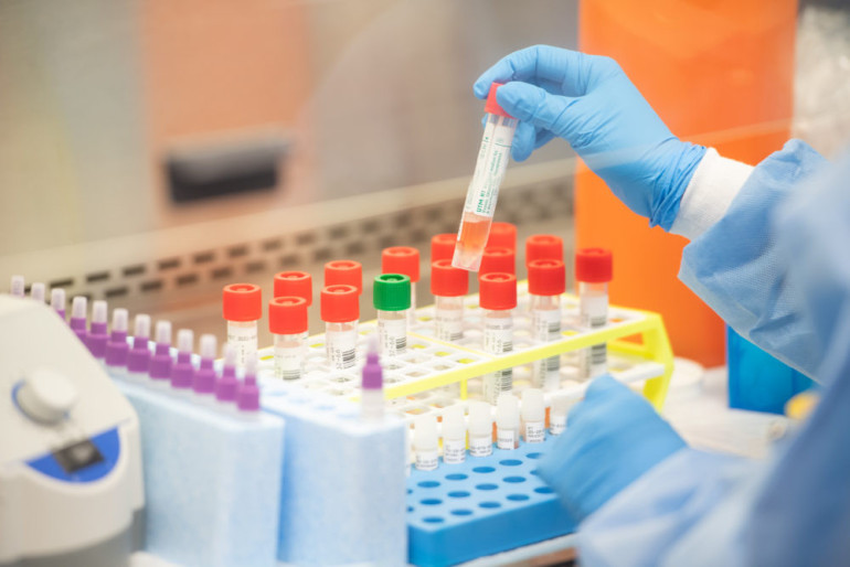 Lab test confirms first case of coronavirus reinfection in the US