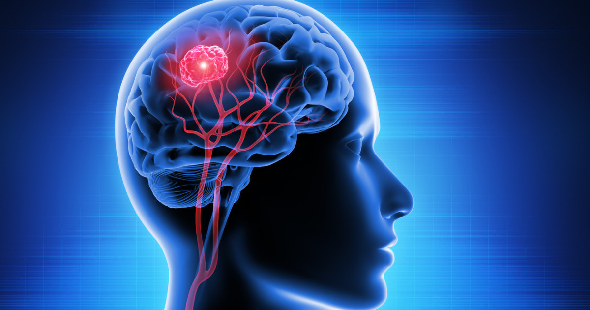 Google helps map one cubic millimeter of human brain tissue that comes ...