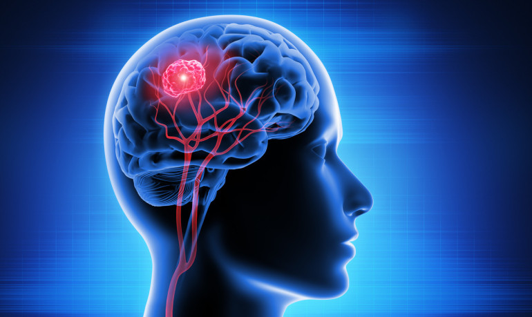 Google helps map one cubic millimeter of human brain tissue that comes ...