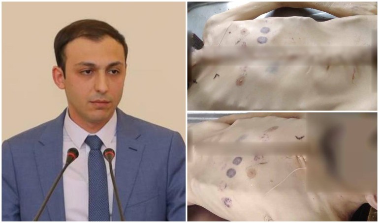 Արցախում սովամահության դեպք է արձանագրվել. Գեղամ Ստեփանյան