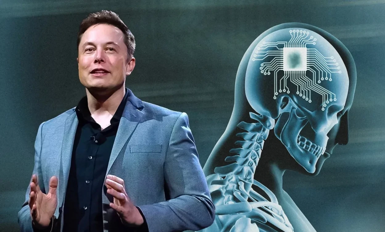 Neuralink-ը չիպ է տեղադրել 2-րդ մարդու ուղեղում. Իլոն Մասկ